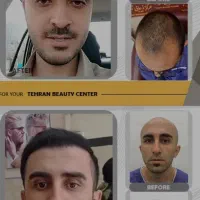 زیبایی/کاشت مو/رفع غبغب/تزریق ژل/ کلینیک در تهران|خدمات آرایشگری و زیبایی|ارومیه, |دیوار