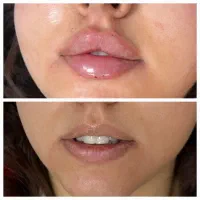 خدمات زیبایی پزشکی تزریق ژل و بوتاکس وچربی