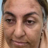 کرم معجزه  اصلی دستساز  متخصص تهران|آرایشی، بهداشتی، درمانی|کوهدشت, |دیوار