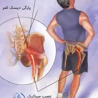 رفع درد کمر پا سیاتیک / ماساژ درمانی کایروپراکتیک|خدمات آرایشگری و زیبایی|اسلام‌شهر, شهرک محمدیه|دیوار