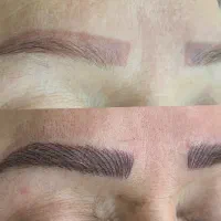 کوتاهی مو و میکروپیگمنیشن