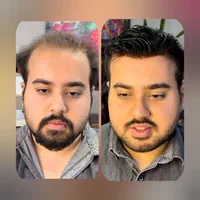 مرکز ترمیم مو /ایران مو /|خدمات آرایشگری و زیبایی|اصفهان, آفاران|دیوار