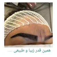 کاشت مو و ابرو در کلینیک تخصصی مزو پی ار پی|خدمات آرایشگری و زیبایی|مشهد, احمدآباد|دیوار