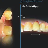 تولید محتوا پست و استوری ویدیو عکس شبکه اجتماعی|خدمات رایانه‌ای و موبایل|کرمانشاه, |دیوار