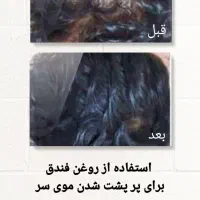 درمان اصلی ریزش مو|آرایشی، بهداشتی، درمانی|شوشتر, |دیوار