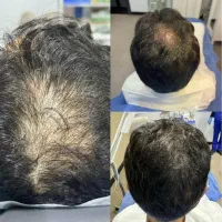 قبل از اینکه کاشت کنی ببین