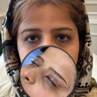 فیلر سی سی۳۳۰ بلفاروپلاستی ۶/۹۰۰ بوتاکس ۲۵۰|خدمات آرایشگری و زیبایی|تهران, صادقیه|دیوار