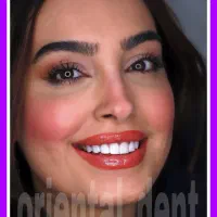 دندانپزشکی اقتصادی/کامپوزیت دندان/عصبکشی/ترمیم|خدمات آرایشگری و زیبایی|تهران, میدان ولیعصر|دیوار