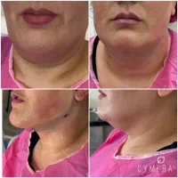 جشنواره زمستانه درمانگاه پوست و‌مو دکتر مساحی