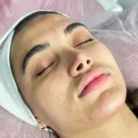 ۳۹۰ تومان فیشال وپاکسازی پوست وپاکسازی مو(اسکالپ)|خدمات آرایشگری و زیبایی|اسلام‌شهر, شهرک قائمیه|دیوار