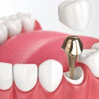 دستیار دندانپزشک