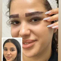 آفرکاشت ابرو۱۳ملیون فقط یک نفر این هفته