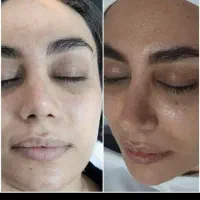 اموزش وخدمات تخصصی پوست باتخفیف بلک فرایدی|خدمات آرایشگری و زیبایی|تربت جام, تیپ ۳۸ زرهی تربت جام|دیوار