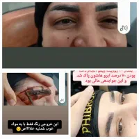 ریموو ابرو بصورت تخصصی بدون آسیب بدون درد