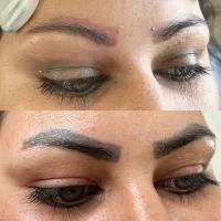 ریموو تک جلسه ای تتو