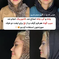 خدمات پوست، مو ، زیبایی|خدمات آرایشگری و زیبایی|تهران, امانیه|دیوار