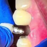 دستیار دندانپزشک خانم نیمه وقت