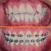 ارتودنسی تمام اقساط بدون چک و ضامن