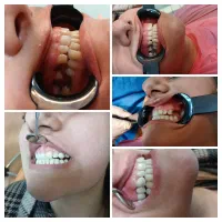 خدمات دندانپزشکی با بهترین مواد و متریال