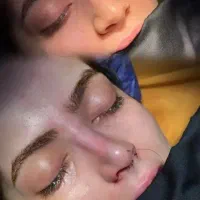 عمل جراحی بینی 27.900تومان/ بهترین متخصص کرج