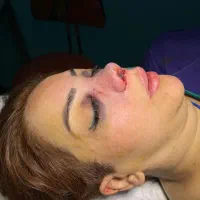 کاشت جراحی بینی غبغب سانترال دایرکت لمینت کامپوزیت|خدمات آرایشگری و زیبایی|قم, سالاریه|دیوار