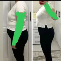 کاهش وزن سالم و ماندگار با مشاوره تخصصی