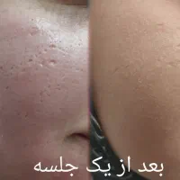 فیشال و درمان مشکلات پوستی