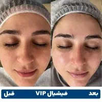 فشیال کلاسیکvip پوست فقط 400تومان به جای 600تومان|خدمات آرایشگری و زیبایی|کرمان, |دیوار