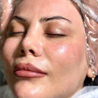 جوانسازی پوست رایگان آقا و خانم