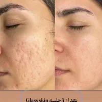 پاکسازی هزینه مواد
