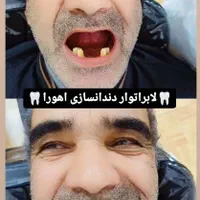 دندان ،دندان سازی ،دندان مصنوعی ،جوان پسند،اقساطی|خدمات آرایشگری و زیبایی|مشهد, شاهد (شهرک غرب)|دیوار