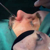 عمل بینی|خدمات آرایشگری و زیبایی|رامشیر, |دیوار