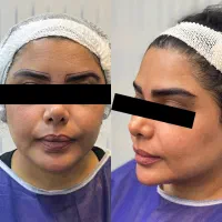 فرصت ویژه و محدود کاشت ابرو|خدمات آرایشگری و زیبایی|رشت, گلسار|دیوار