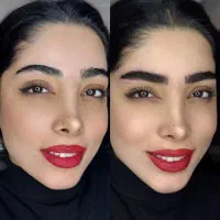 آموزش میکروبلیدینگ با متود سوپرنچرال