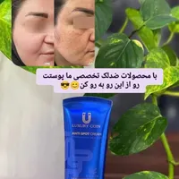 کرم ضدلک لاکچری کوین|آرایشی، بهداشتی، درمانی|تبریز, |دیوار
