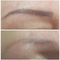 حذف تتو/رفع کک و مک/کربن تراپی/روشنسازی نواحی تیره|خدمات آرایشگری و زیبایی|مسجد سلیمان, |دیوار