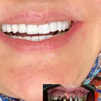 دندانپزشکی، کامپوزیت دندان|خدمات آرایشگری و زیبایی|تهران, تهرانپارس غربی|دیوار