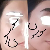 روشن کننده وضدلک درمانی جوابدهی صدرصدی وتضمینی|حراج|لردگان, |دیوار