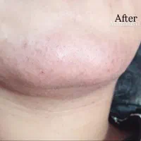 خدمات و آموزش فیشیال و الکترولیز موی زائد|خدمات آرایشگری و زیبایی|بندرعباس, |دیوار