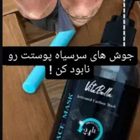 جوش های سر سیاهت رو نابود کن دیگه