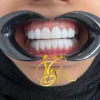 دندانپزشکی/کامپوزیت/عصبکشی/روکش/ترمیم و پالیش