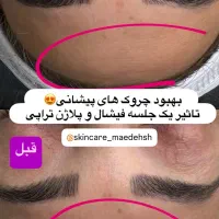 پوست سالم میخوای من کمکت میکنم فیشال بانوان|خدمات آرایشگری و زیبایی|شیراز, بعثت|دیوار