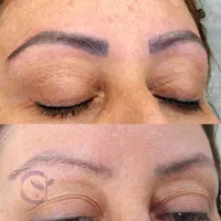 حذف تتو|خدمات آرایشگری و زیبایی|قم, صدوق|دیوار