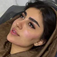 تزریق ژل فول فیس سی سی ۶۹۹|خدمات آرایشگری و زیبایی|اصفهان, خانه اصفهان|دیوار