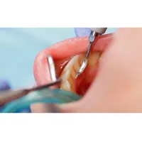 خدمات دندانپزشکی با کیفیت|خدمات آرایشگری و زیبایی|رشت, استادسرا|دیوار