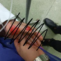 ارائه خدمات پرستاری در خانه