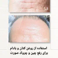 روغن های درمانی معجزه سلامتی