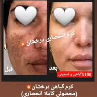 کرم ضدلک و روشن کننده درخشان(بدون بازگشت)