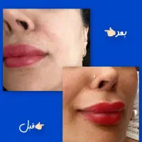 تخفیف ویژه خدمات لاغری