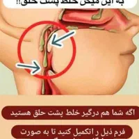 درمان خلط پشت حلق و کبد چرب و مزاج